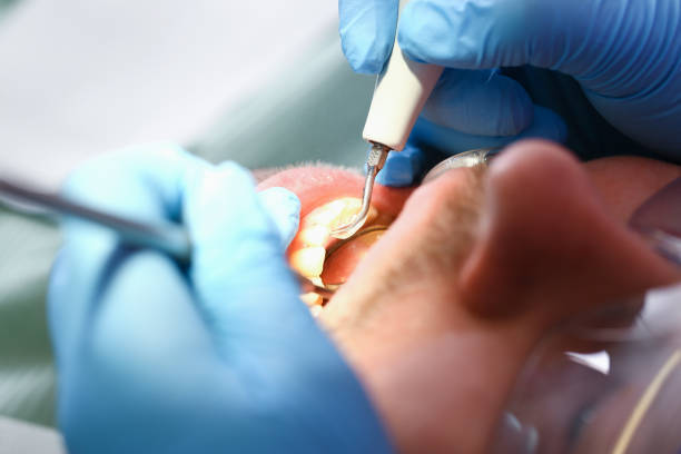 Best Broken Tooth Emergency  in Briar, TX